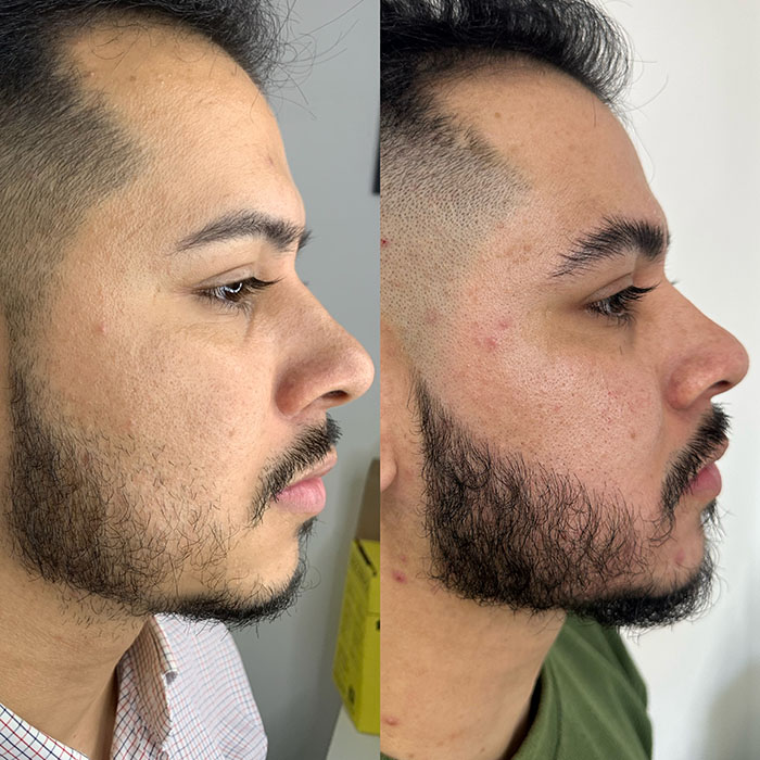 Barba