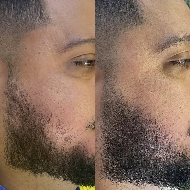 Barba 02