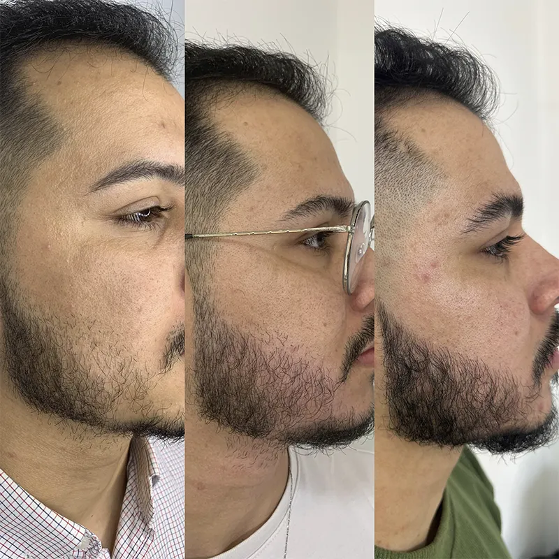 Barba 03