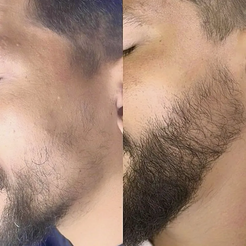 Barba 04