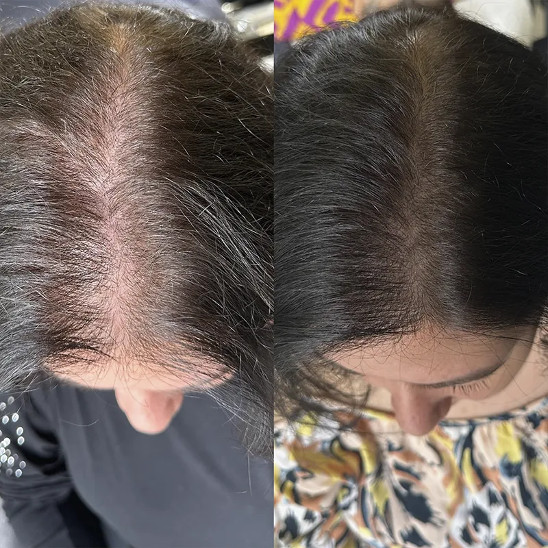 Cabelo 01
