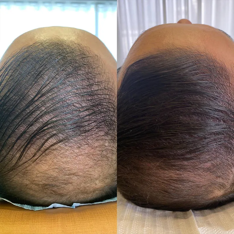 Cabelo 02