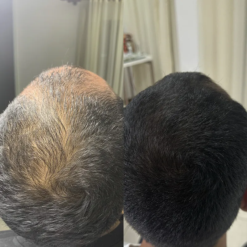 Cabelo 05