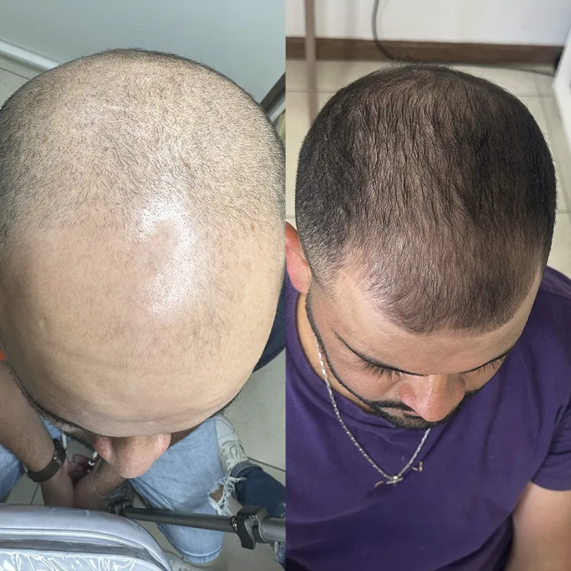 Cabelo 06