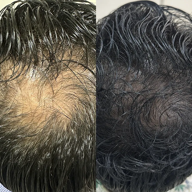 Cabelo 07