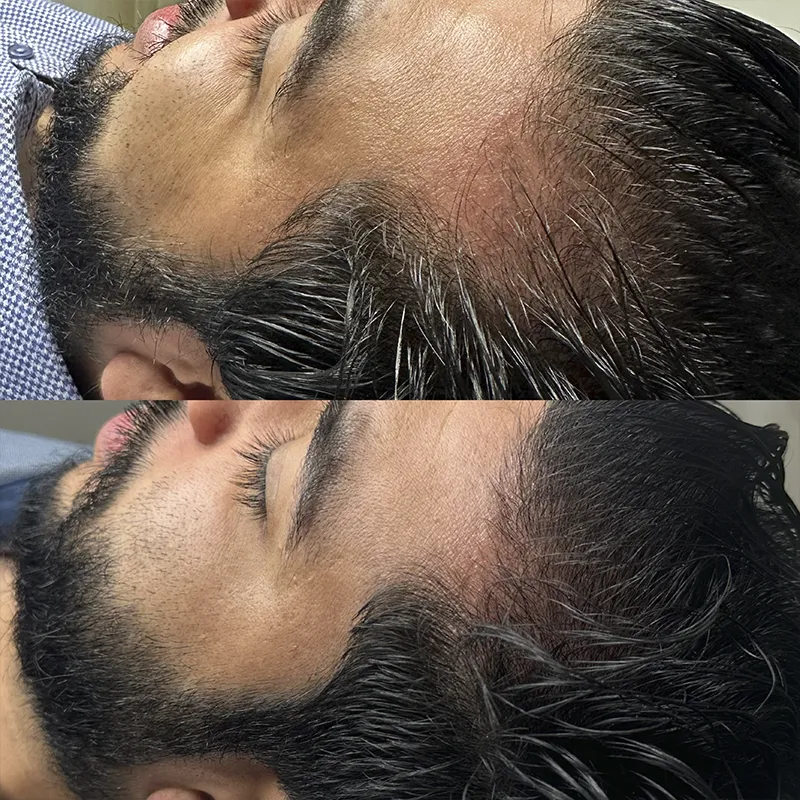 Cabelo 08