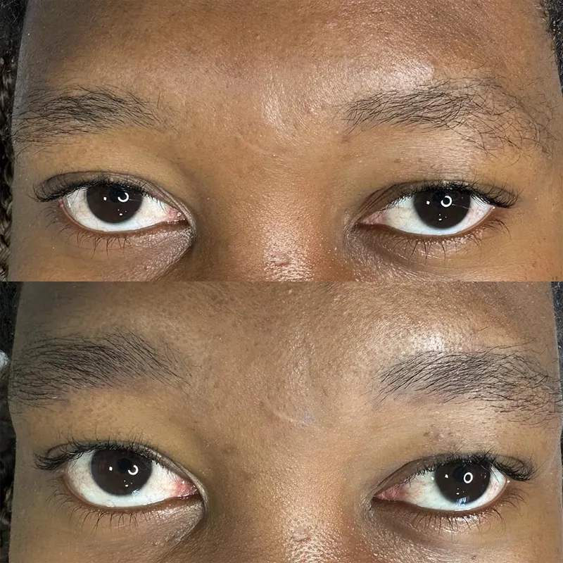 Sobrancelha 04