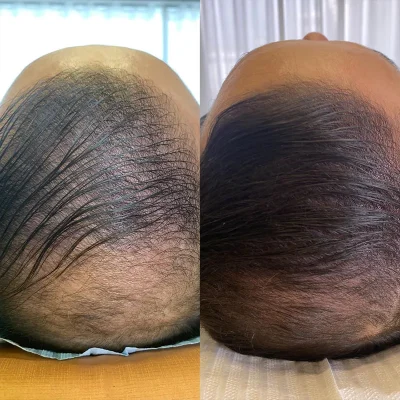 Cabelo 02