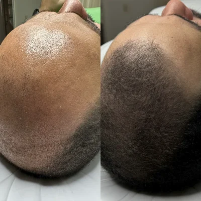 Cabelo 04