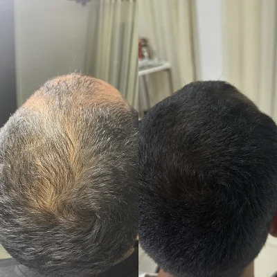 Cabelo 05