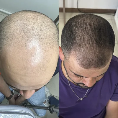 Cabelo 06