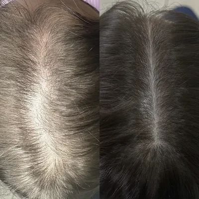 Cabelo 09